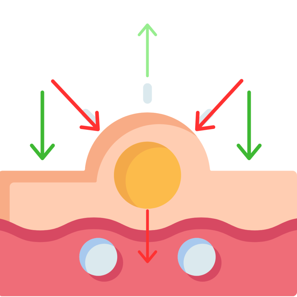 acne, pimple, breakouts, acne scars, hormonal acne, how to heal acne